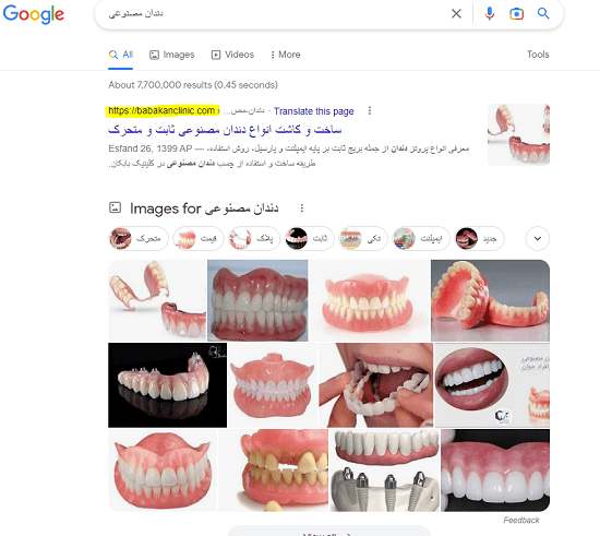 رتبه 1 دندان مصنوعی